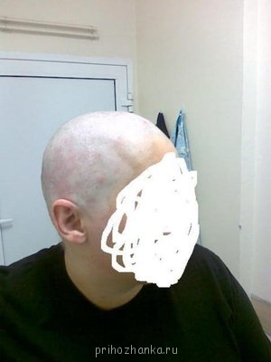 это перед операцией