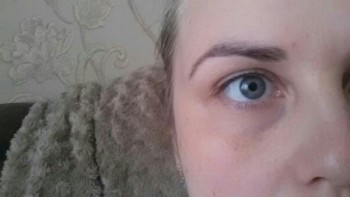 Две недели после процедуры, корочки полностью сошли, татуаж, как и обещали, почти не виден.