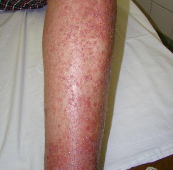 Осторожно, БОРЩЕВИК  - 35328240_808579759345460_3733716796713205760_n.jpg