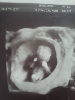 Голосуем ПРОТИВ петиции  - 20190322_141848.jpg