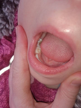 Первые зубки - IMG_20220305_132800.jpg