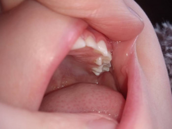 Первые зубки - IMG_20220305_131300.jpg