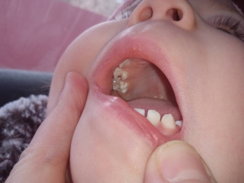 Первые зубки - IMG_20220305_132834.jpg