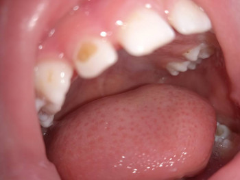 Первые зубки - IMG_20220305_131218.jpg